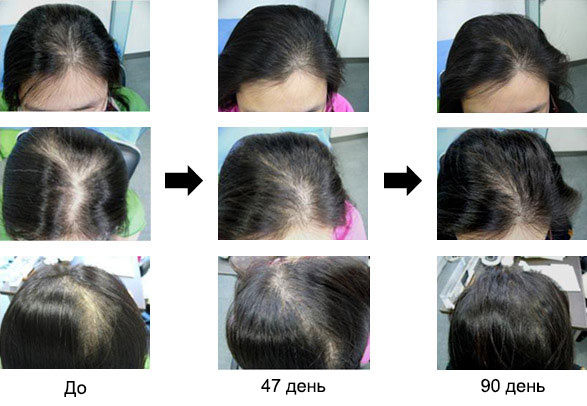 Case 1. 32-year-old Woman