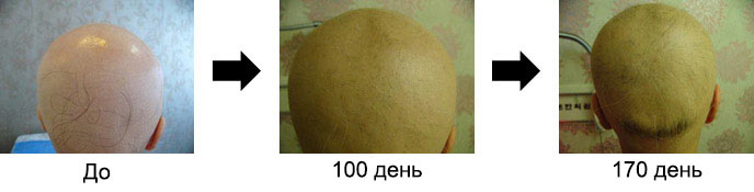 Case 2. 23-year-old Woman