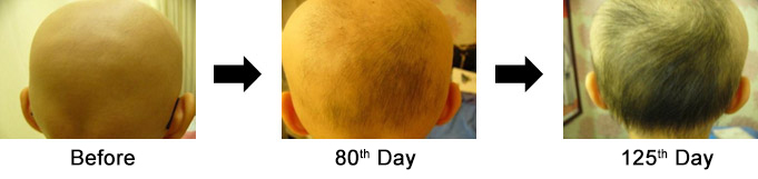 Case 3. 15-year-old Man