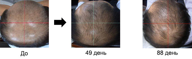 Case #4. 47-year-old Man