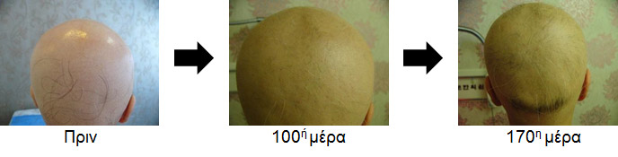 Περίπτωση 2. Γυναίκα 23 ετών