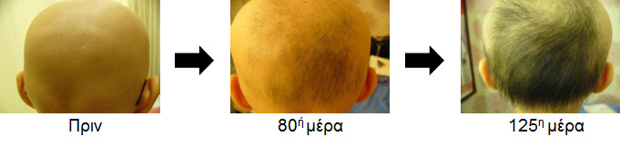 Περίπτωση 3. Άνδρας 15 ετών