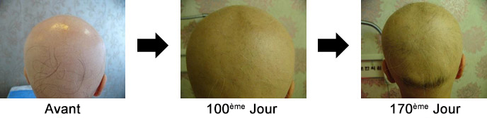 Cas 2. Femme de 23 ans