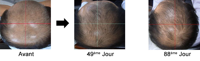 Cas 4. Homme de 47 ans